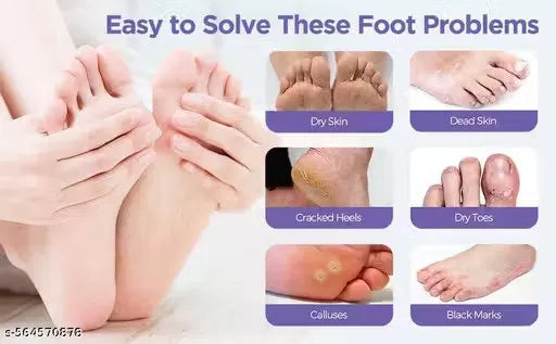 Silky & Exfoliating Foot Mask | Removes Dead Skin, Repairs Cracked Heels & Softens Feet